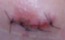 Xan's chin